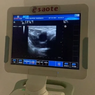 Senza-titolo https://www.fisioterapiagaluppini.it/wp-content/uploads/2026/09/Senza-titolo-320x320.webp